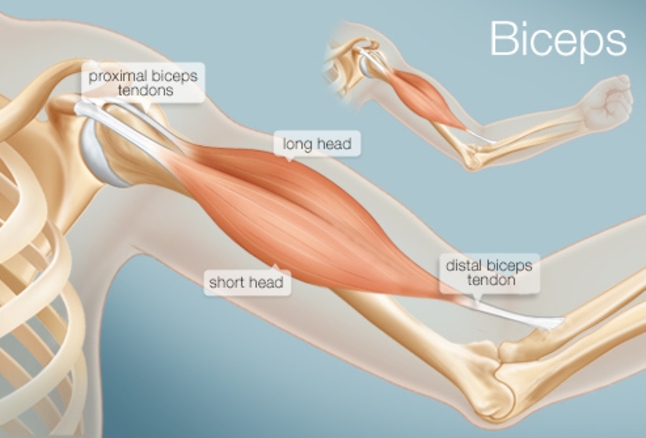 diagram of a biceps tendon tear
